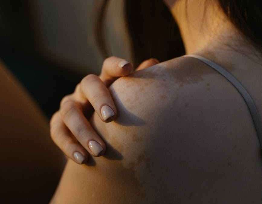 TU PIEL NECESITA DE UN AUTOEXAMEN